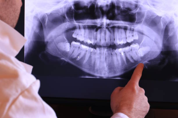 Best Broken or Cracked Tooth Emergency Dentist in Dover Plains, NY